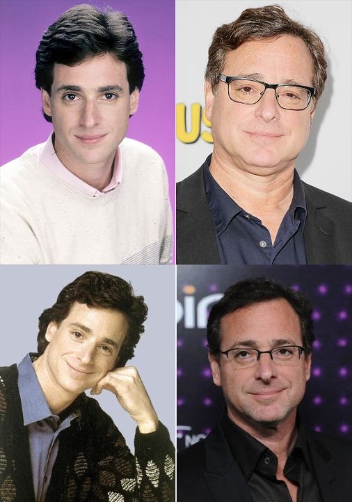 Bob Saget before and after alleged plastic surgery.