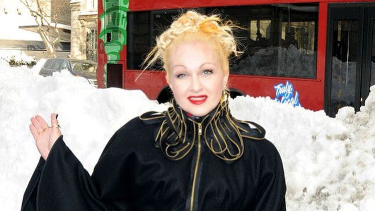 Cyndi Lauper's Plastic Surgery: The Real Truth Behind Her Face!