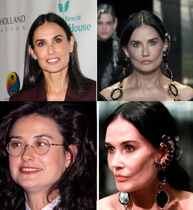 Demi Moore before and after alleged plastic surgery.