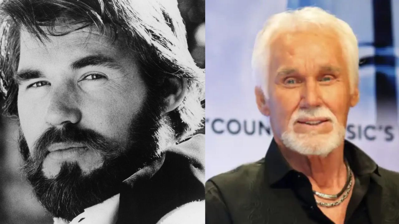 Kenny Rogers before and after plastic surgery.