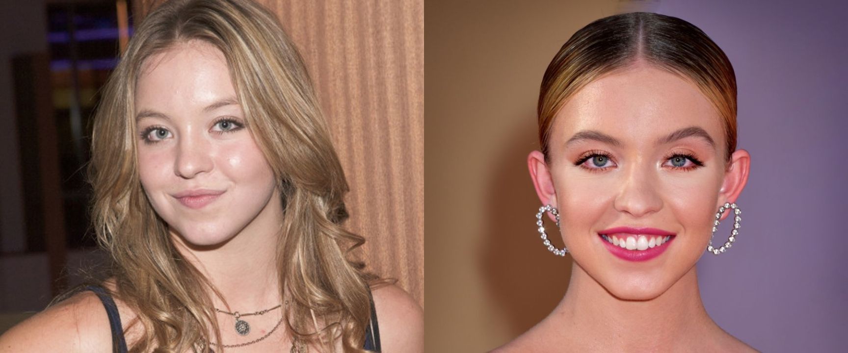 Sydney Sweeney before and after alleged plastic surgery.