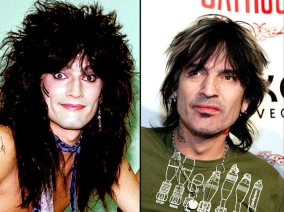 Tommy Lee before and after alleged plastic surgery.