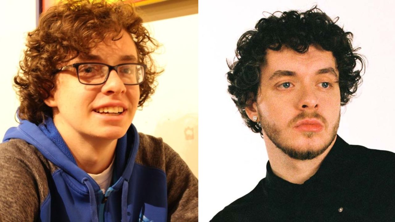 Jack Harlow's Plastic Surgery: Before and After Glow Up Examined!