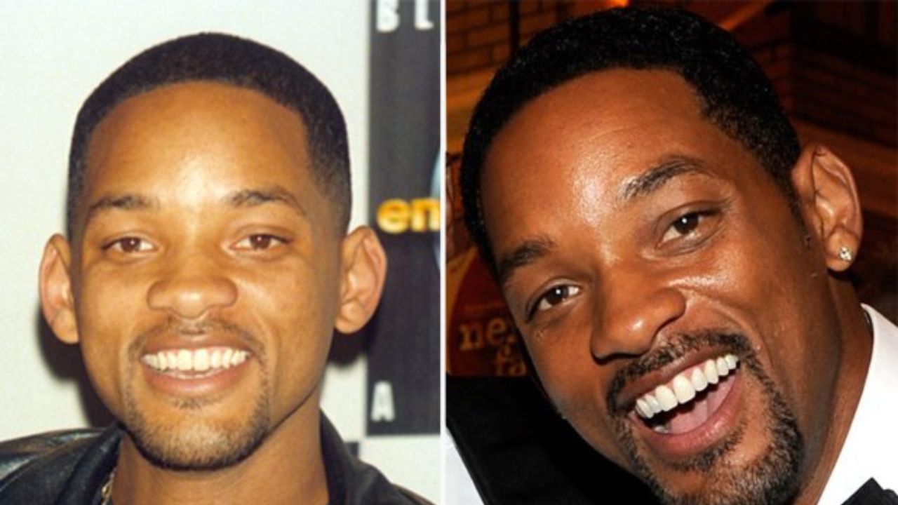 Will Smith's Plastic Surgery: Learn the Real Truth!