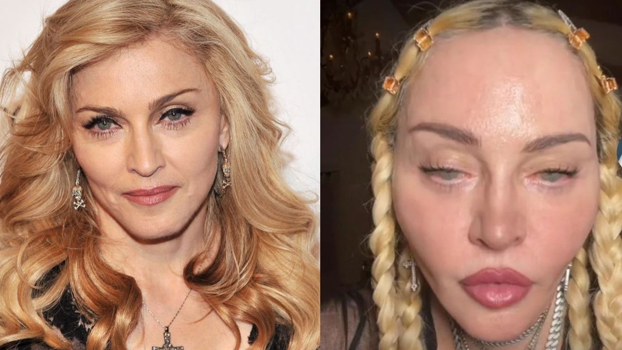 Madonna's Plastic Surgery 2022: Reddit Examines Her Buttocks & Implant!