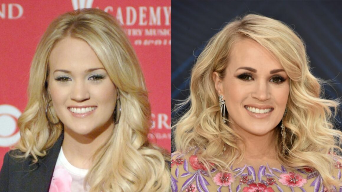 Carrie Underwood's Plastic Surgery: Was Her Freak Accident Just a Coverup For Getting Plastic Surgery?