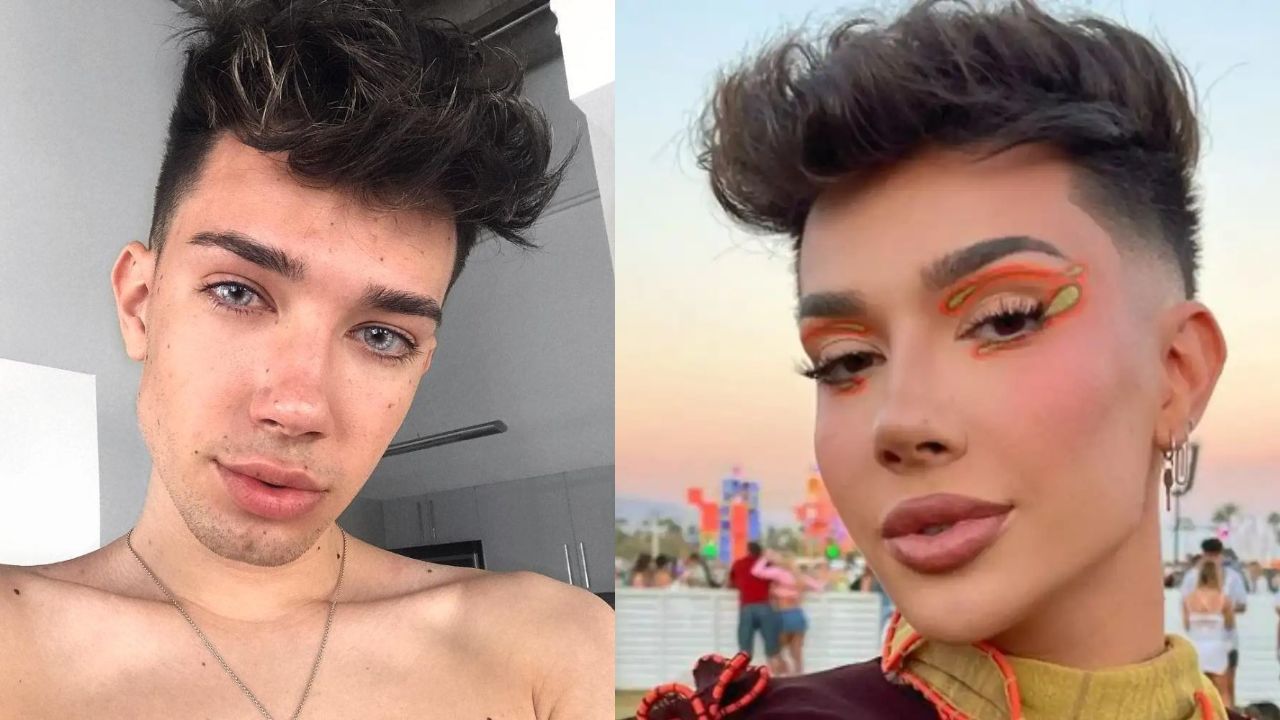 James Charles’ Plastic Surgery: Speculations of BBL Surgery, Botox, Lip Fillers & More!
