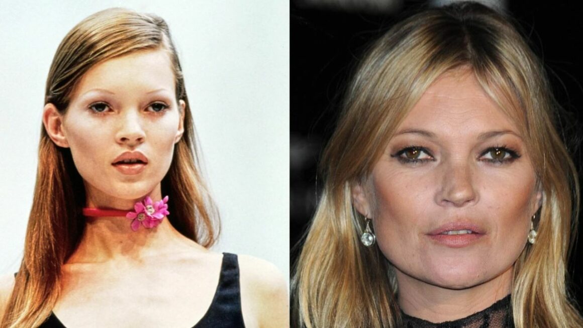 Kate Moss' Plastic Surgery: The Supermodel's Pictures Then and Now; Still Looks Very Young!