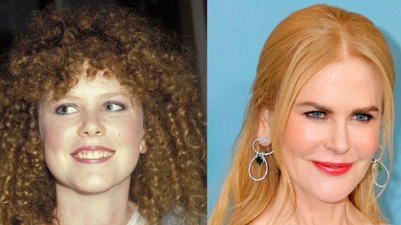 Nicole Kidman's Plastic Surgery: The Northman Star's Transformation With Before And After Pictures!