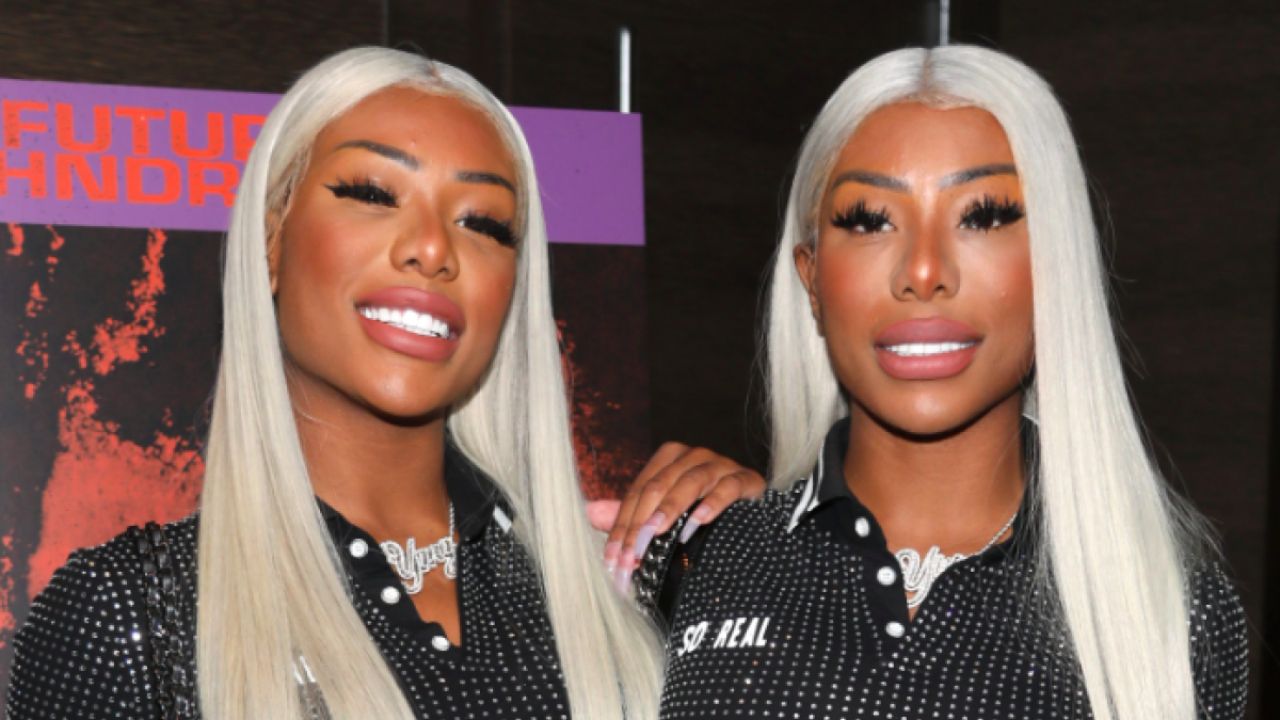Clermont Twins Before Plastic Surgery: Following Their Jail Time and Controversies, the Twins’ Before and After Pictures Is More Shocking to the Crowd!