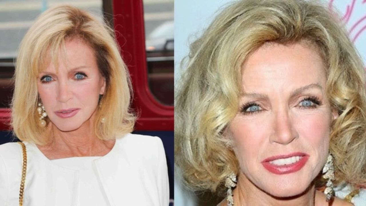 Donna Mills' Plastic Surgery Speculations 2022: Botox, Rhinoplasty, Fillers & More!