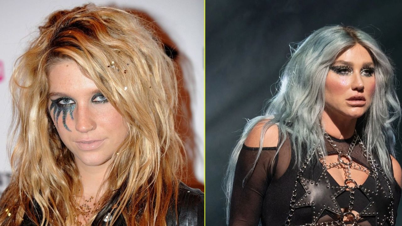 Did Kesha Have Plastic Surgery? How Was the Singer Before Any Cosmetic Enhancement?
