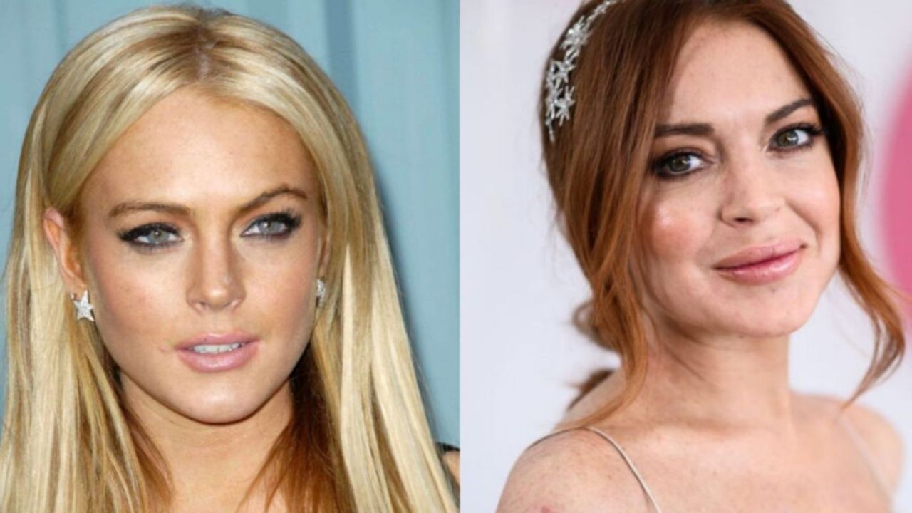 Did Lindsay Lohan Have Plastic Surgery? How Does the Mean Gi