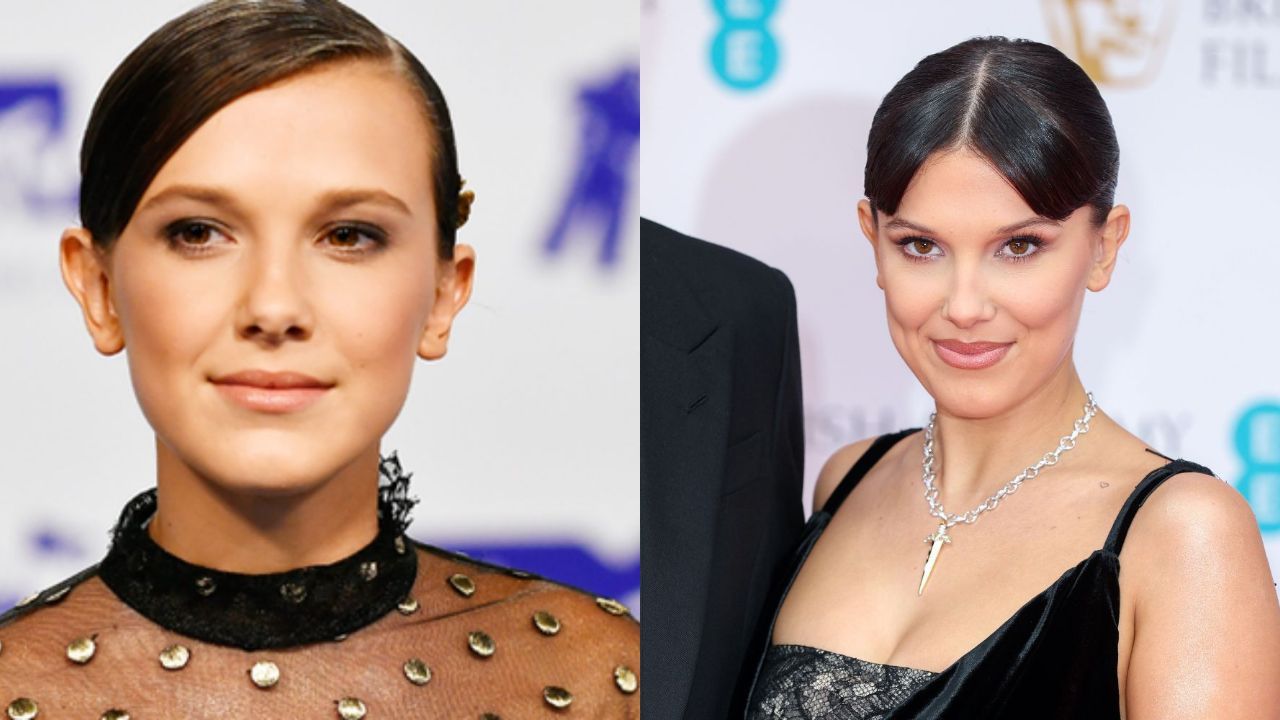 Millie Bobby Brown’s Plastic Surgery: Before and After Teeth Surgery; Veneers & Invisalign!