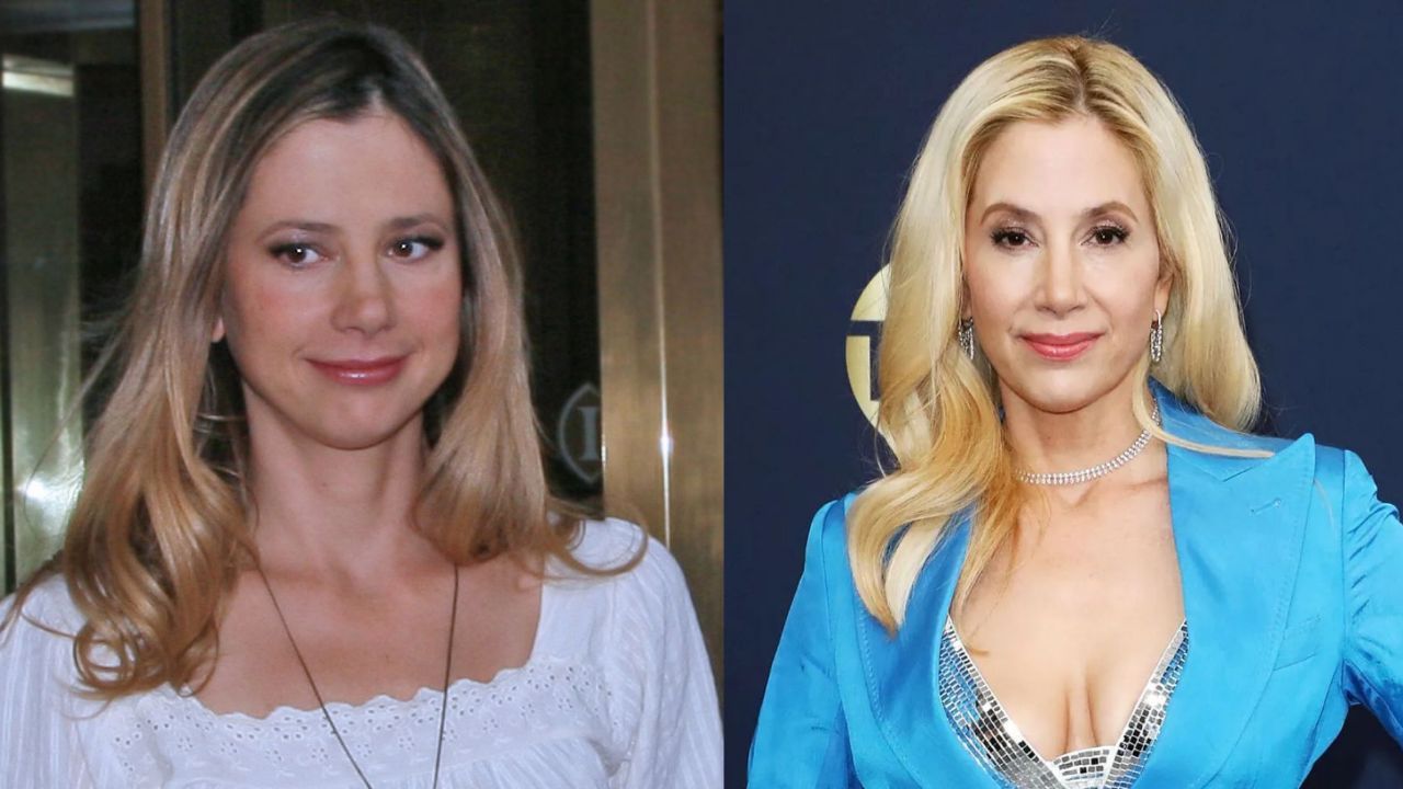 Did Mira Sorvino Undergo Plastic Surgery? How Did She Conceal the Wrinkles?