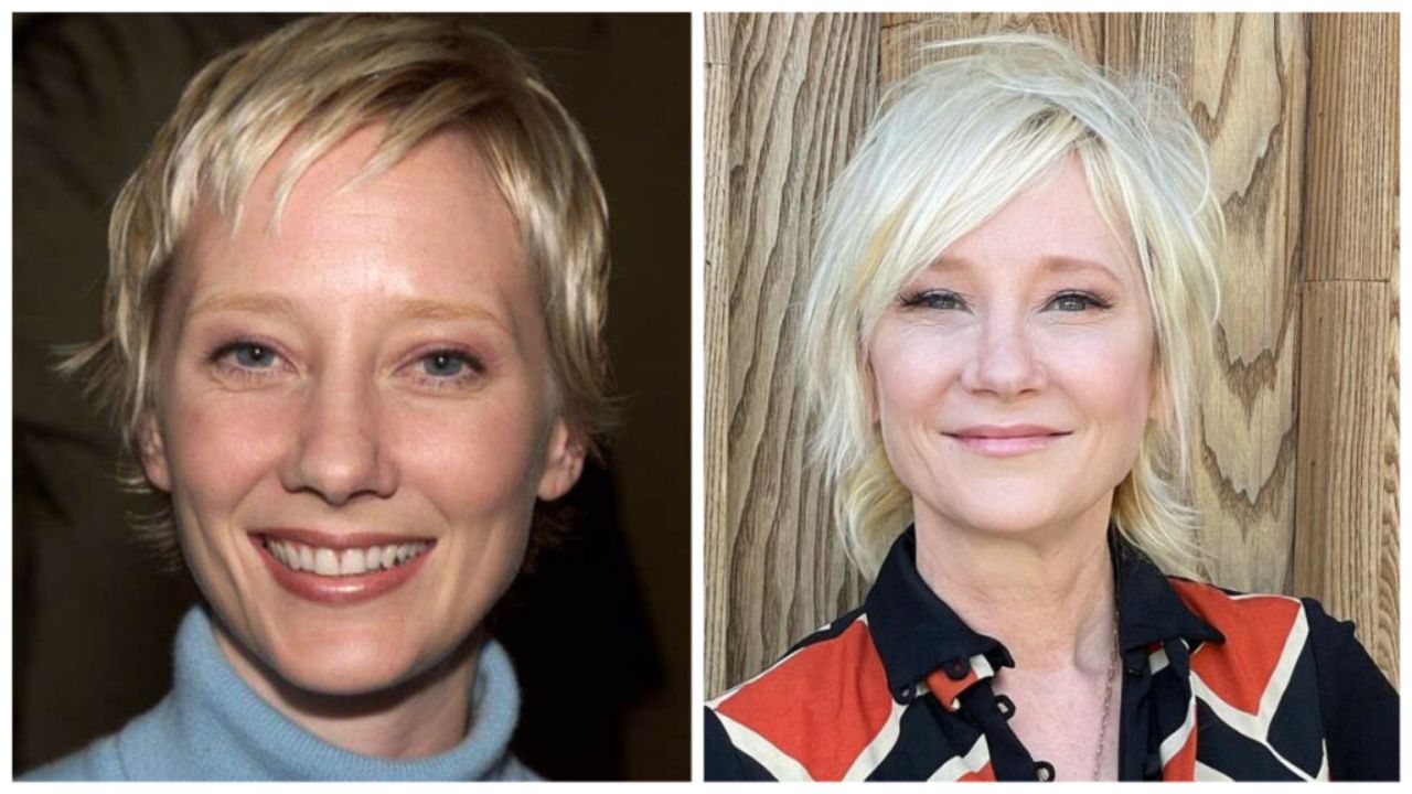 Anne Heche’s Plastic Surgery: Has the 53-Year-Old Actress Undergone Any Cosmetic Enhancement?