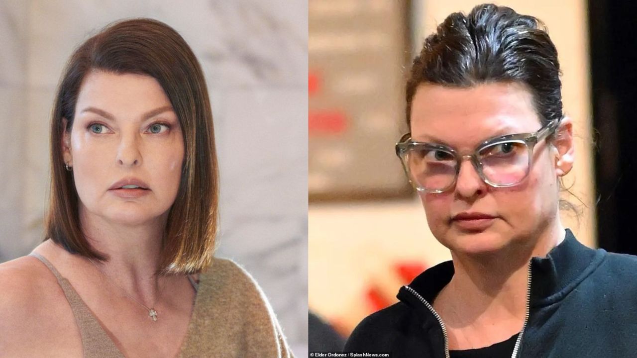 Linda Evangelista’s Botched Plastic Surgery: How Does Her Face Look Now? Before & After Photos Examined!