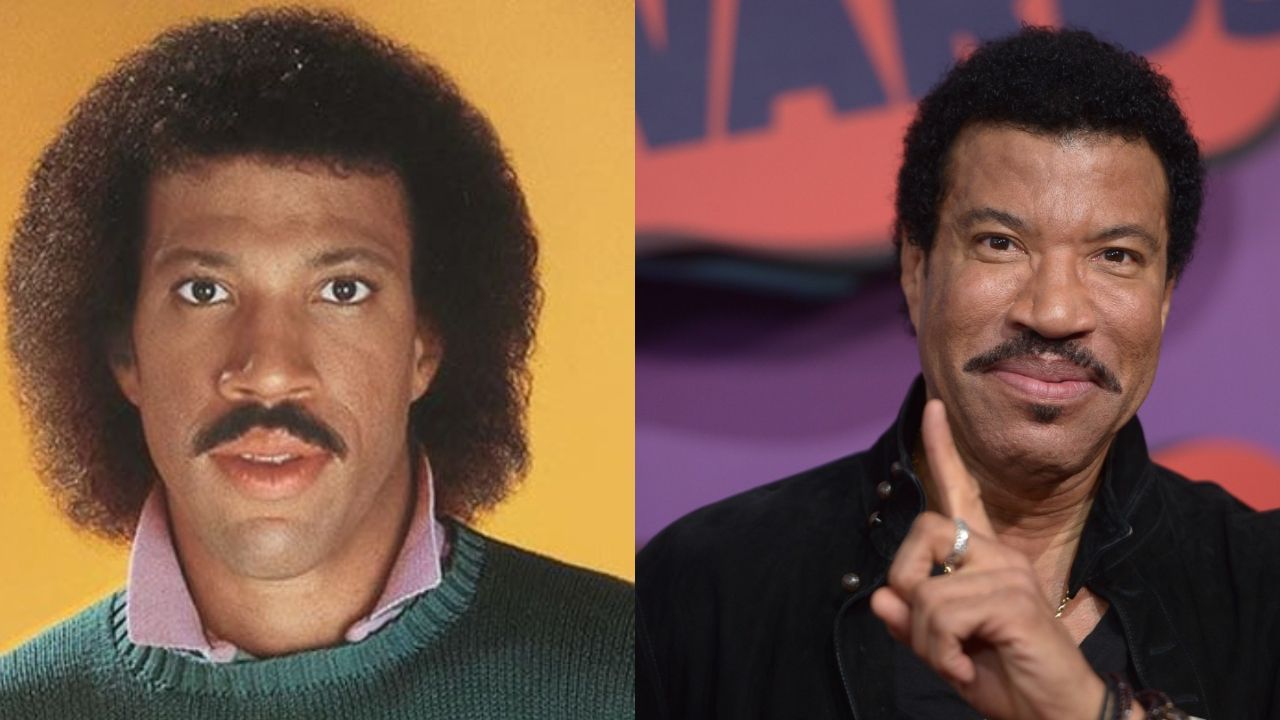 Lionel Richie’s Plastic Surgery: Did the American Idol Host Undergo Botox, Facelift, and Hair Transplant? A Complete Breakdown on His Transformation!