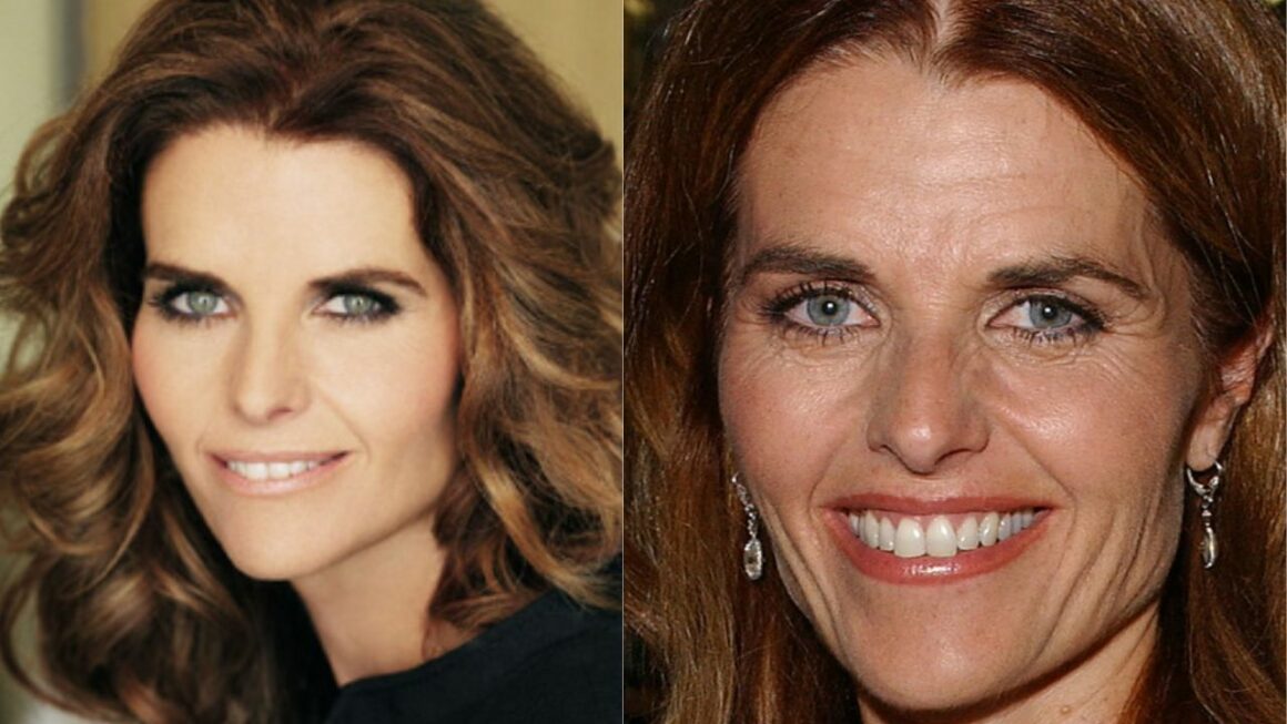 Has Maria Shriver Had Plastic Surgery? What Happened to Her Face Now? 2022 Update!