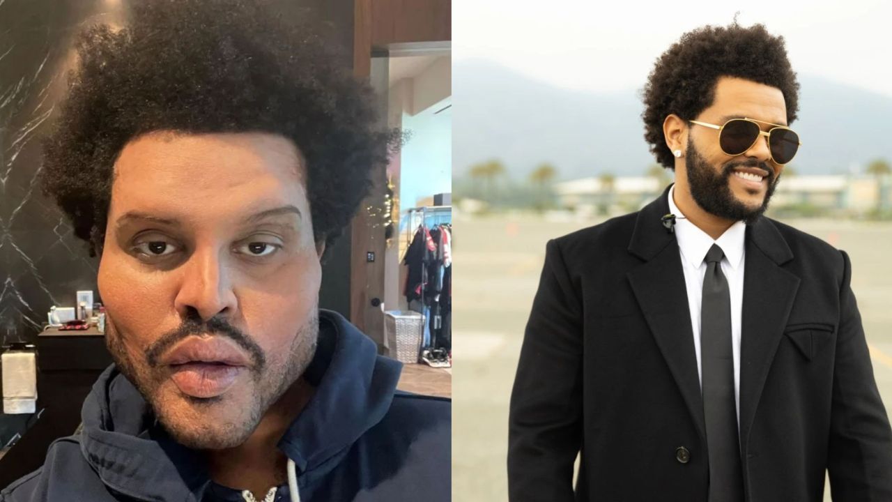 The Weeknd’s Plastic Surgery Song: Did the Save Your Tears Singer Go Under the Knife? Before & After Pictures Examined; How Does He AKA Abel Makkonen Tesfaye Look Right Now in 2022?