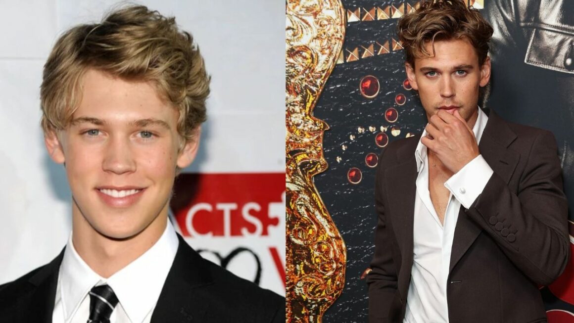 Austin Butler’s Plastic Surgery: Has the Elvis Actor Undergone Cosmetic Enhancements? What Happened to His Lips? Before & After Pictures Examined!