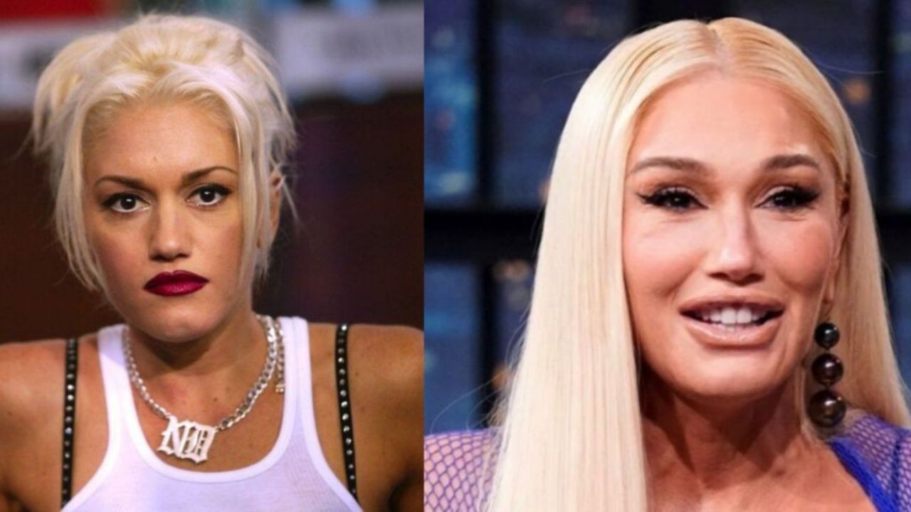 Gwen Stefani’s Plastic Surgery Interview: Reddit Users Are Interested to Know About Her Cosmetic Treatments in 2022!