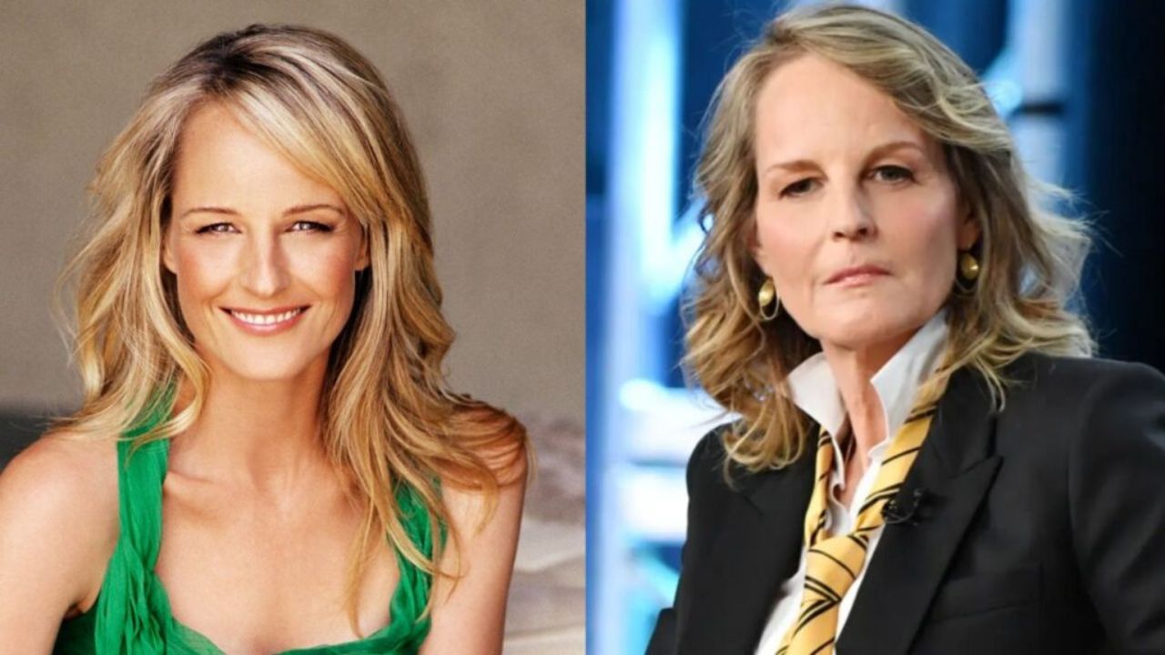 Did Helen Hunt Have Plastic Surgery? Face Accident & 2022 Update; Now and Then Pictures Examined!