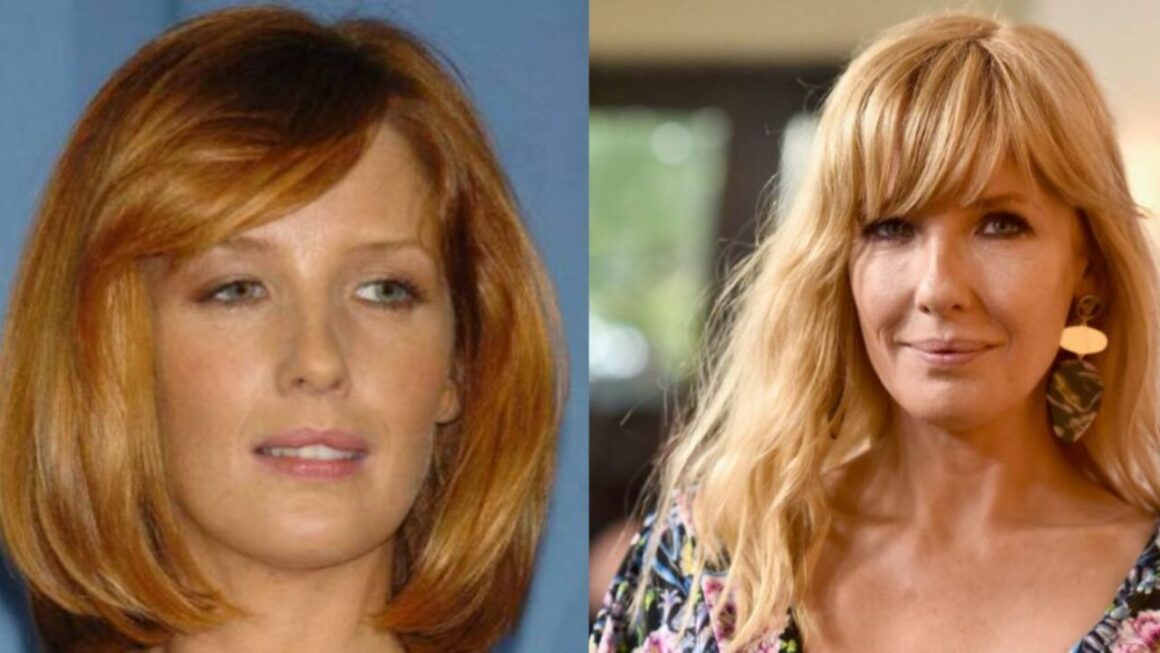 Kelly Reilly’s Plastic Surgery: The Yellowstone Cast Has Been Accused of Undergoing Multiple Cosmetic Treatments!