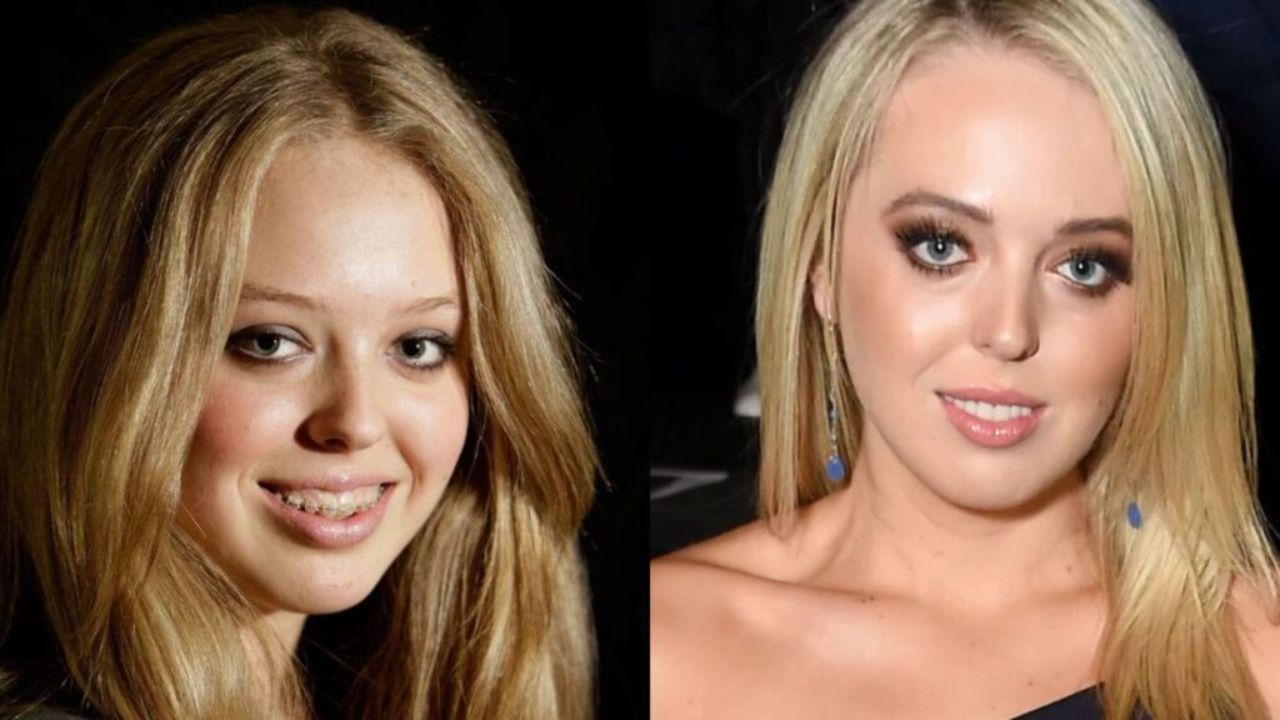 Tiffany Trump’s Plastic Surgery: She Looks Totally Different in Her No Makeup Look!