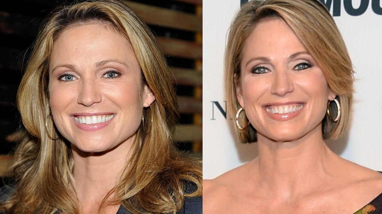 Amy Robach's Plastic Surgery: Did The Good Morning America Anchor Have Jaw Fillers, a Facelift, and Botox?