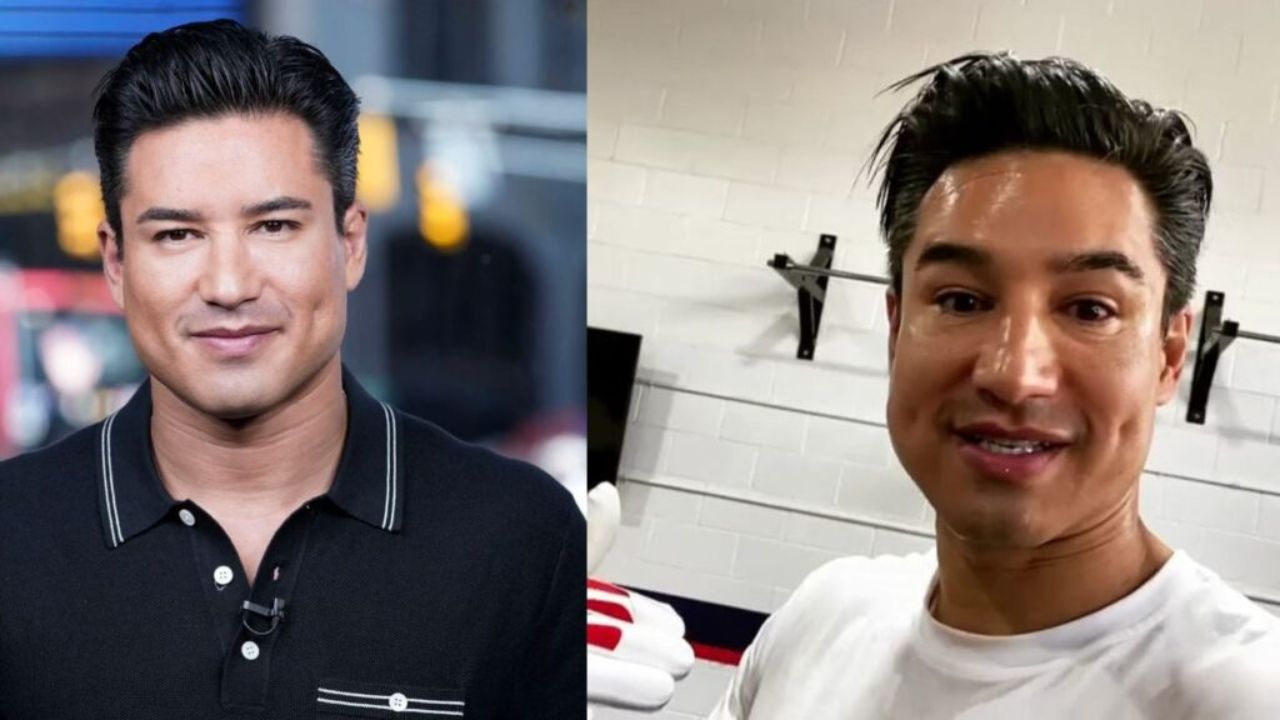 2022: Did Mario Lopez Have Plastic Surgery? What Happened to His Face? Then and Now Pictures Examined!
