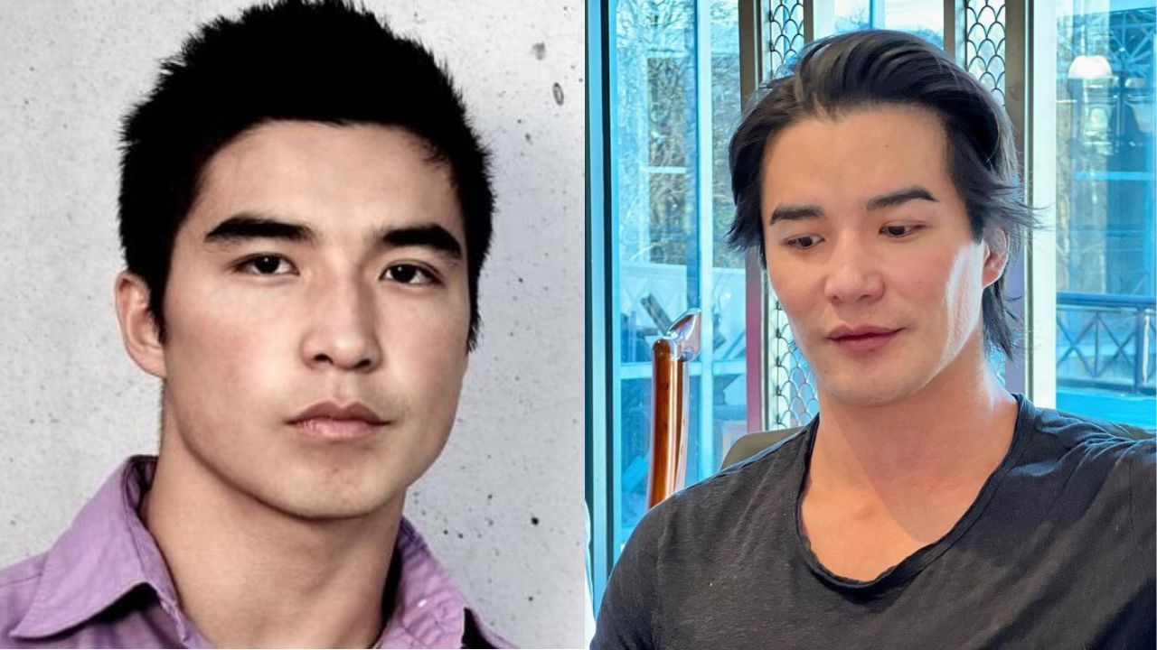 Ludi Lin's Plastic Surgery: Did the Power Ranger Star Alter His Face With the Help of Cosmetic Surgeon?