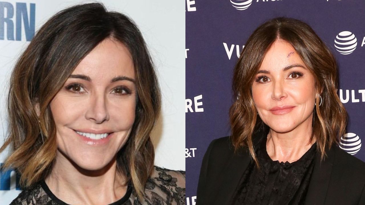 Christa Miller’s Plastic Surgery: The Shrinking Cast Has Been Accused of Undergoing Multiple Cosmetic Treatments!