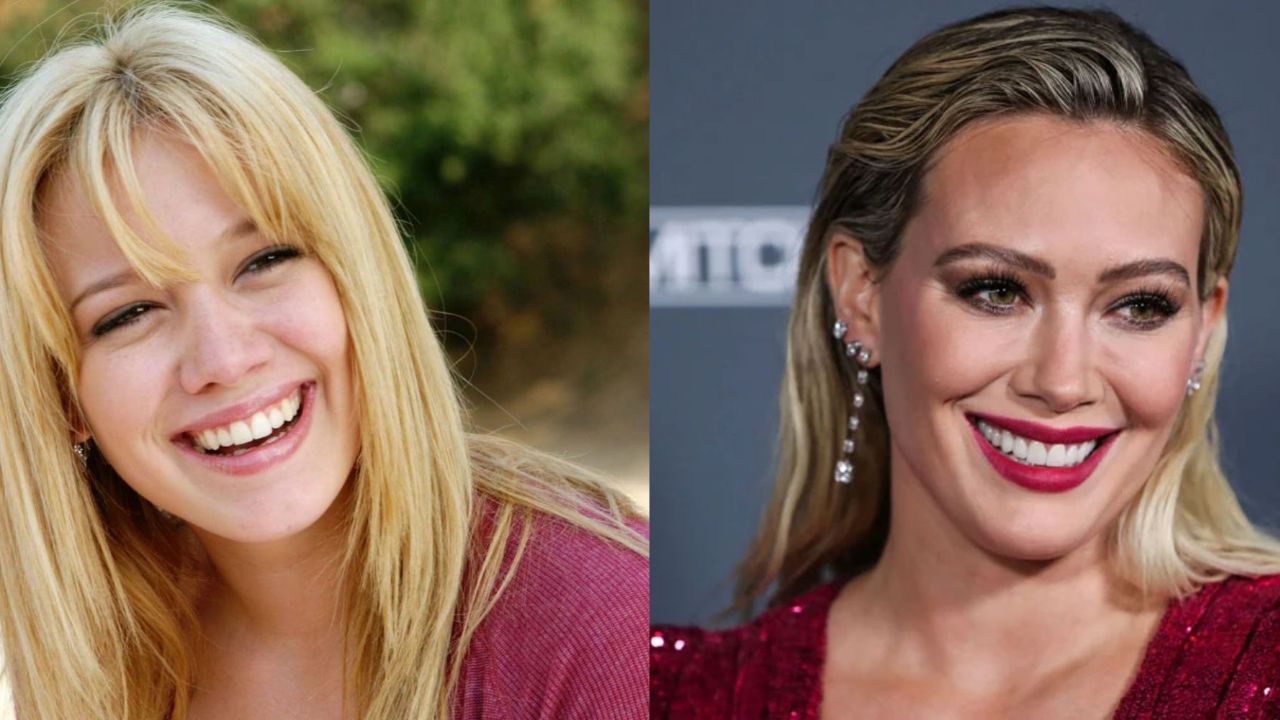 Hilary Duff’s Plastic Surgery: The How I Met Your Father Cast Looks More Younger Now!