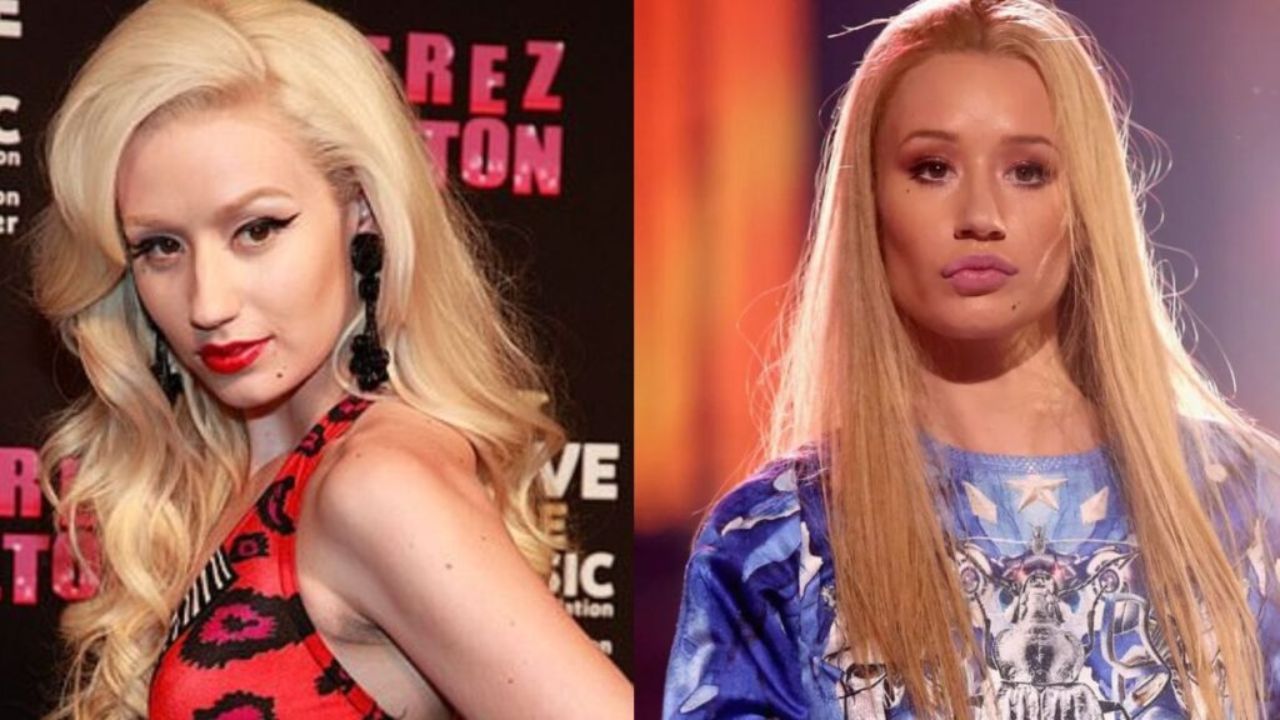 Iggy Azalea Before Plastic Surgery: The Rapper Now Looks Younger & Beautiful!