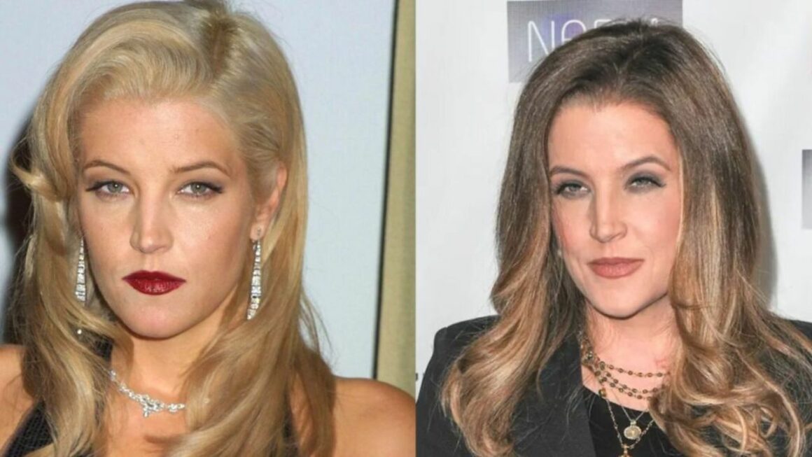 Did Lisa Marie Presley Have Plastic Surgery? The 54-Year-Old Star Was Accused of Multiple Cosmetic Treatments!