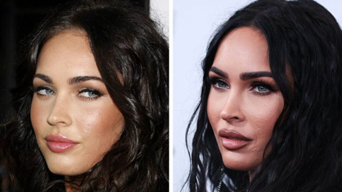 Megan Fox Before and After Plastic Surgery: The 36-Year-Old Still Looks Young in 2022!