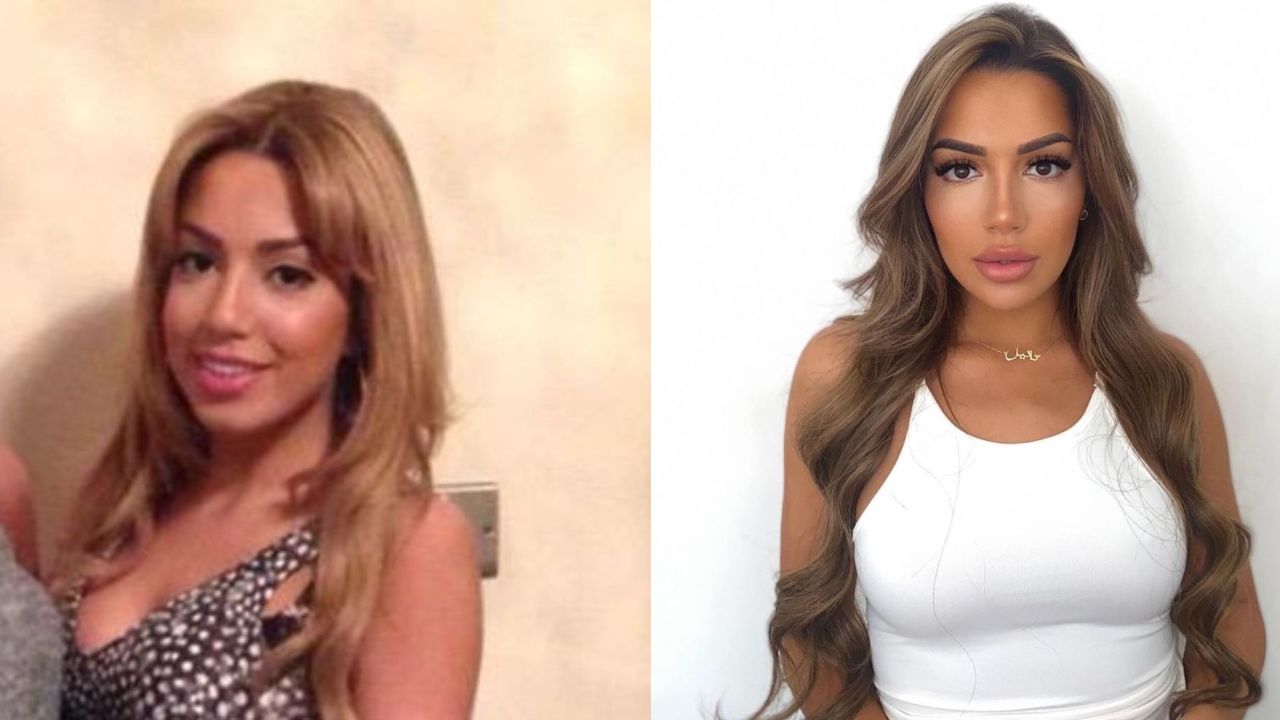 Tanyel Revan Before Plastic Surgery: The Love Island Cast Is Open About Her Cosmetic Treatments and Aftermaths!