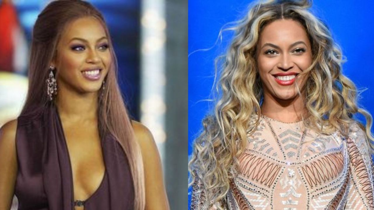 Beyonce's Plastic Surgery: What Cosmetic Procedures Did the Superstar Get for a Youthful Face and an Hourglass-Shaped Body?