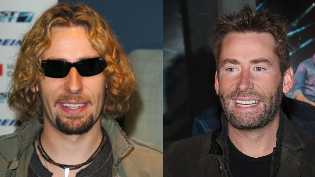 Chad Kroeger’s Plastic Surgery: The 48-Year-Old Canadian Singer’s Appearance Has Changed Significantly!