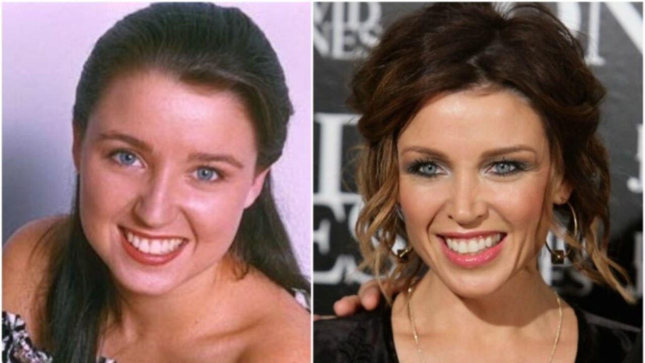 Dannii Minogue before and after plastic surgery.
