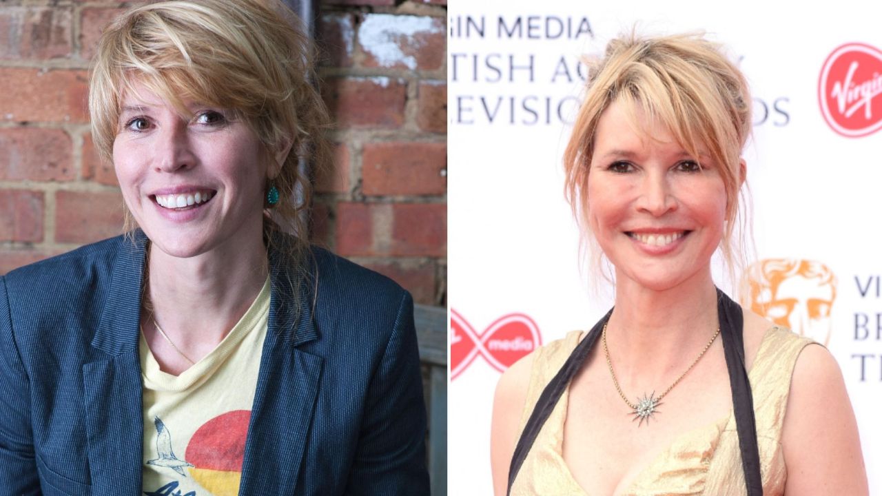 Julia Davis’ Plastic Surgery: The English Actress Has Been Accused of Receiving Multiple Cosmetic Treatments!