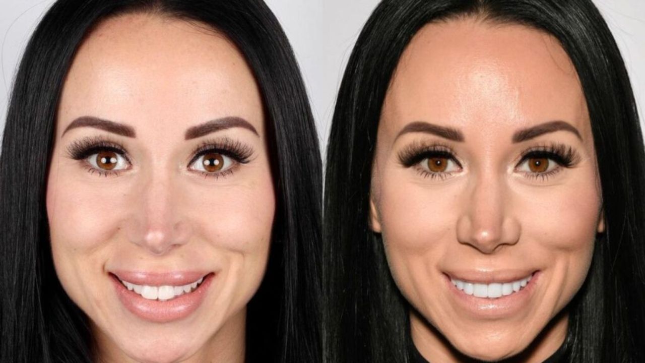 Rachel Fuda Before Plastic Surgery: The Real Housewives of New Jersey Cast Is Open About Her Nose Job!