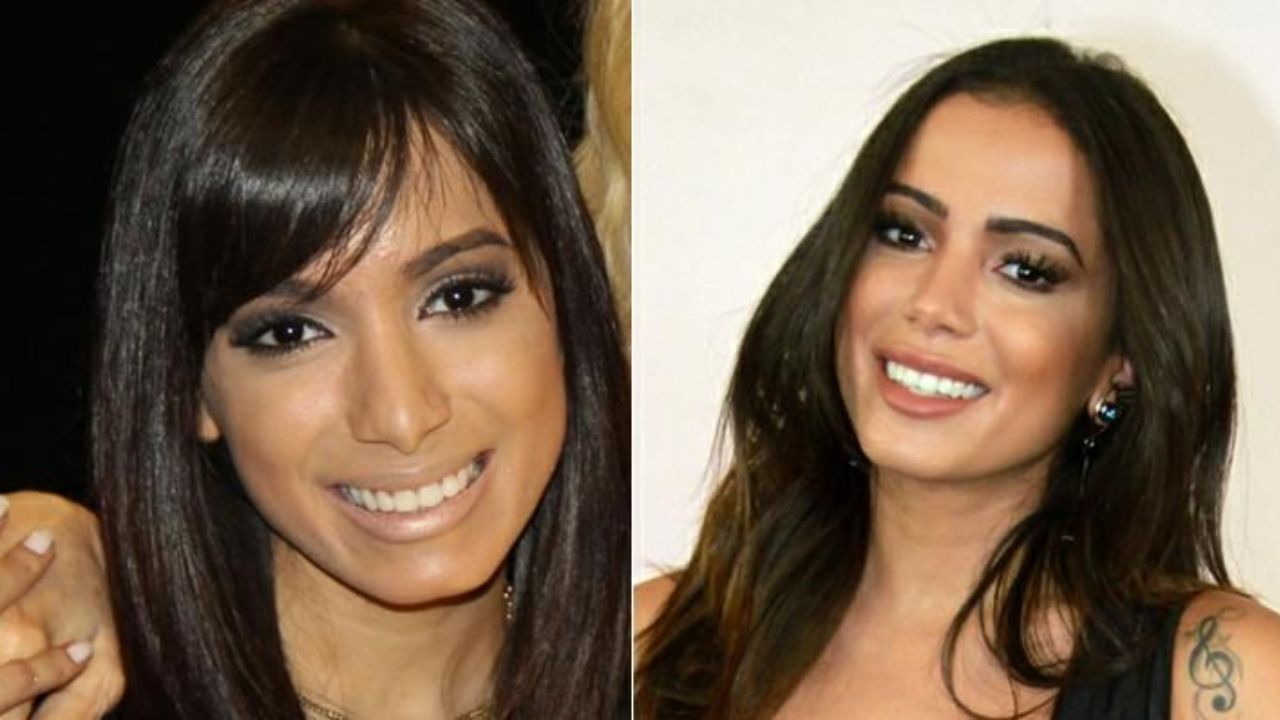 Anitta before and after plastic surgery.