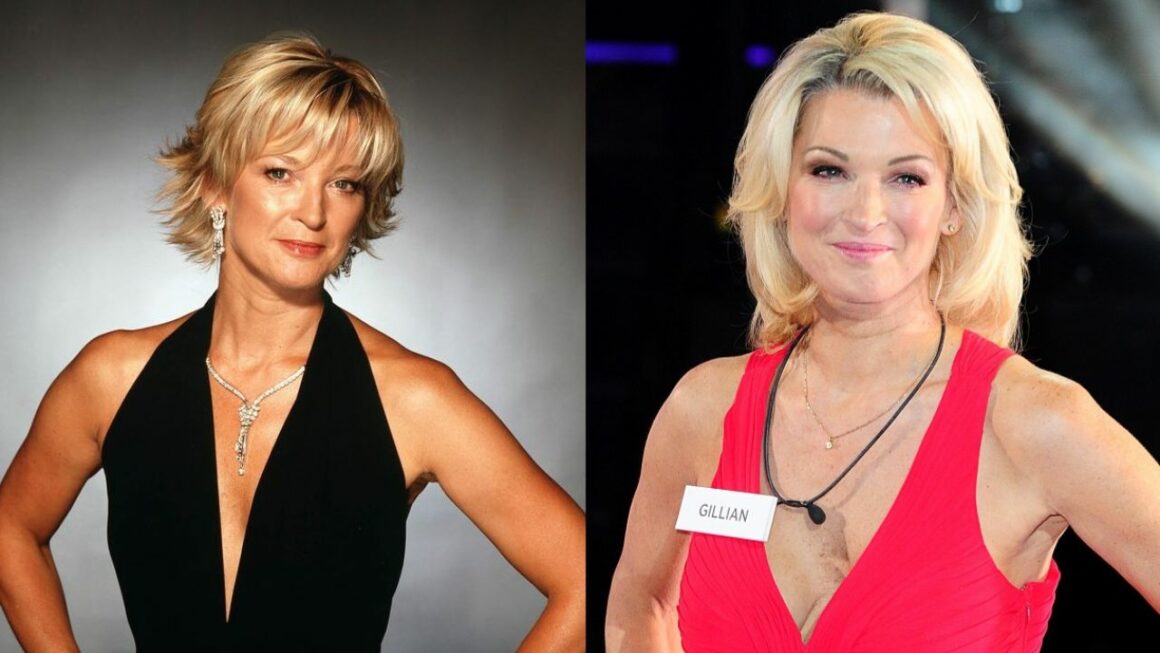 Gillian Taylforth’s Plastic Surgery: Did She Get Facelift?