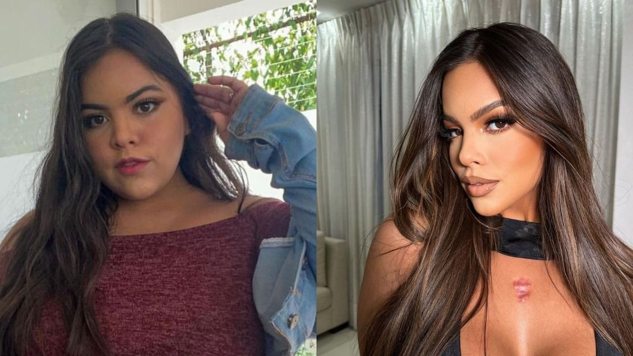 Gracie Bon’s Plastic Surgery: Have a Look at Her Unreal Transformation!