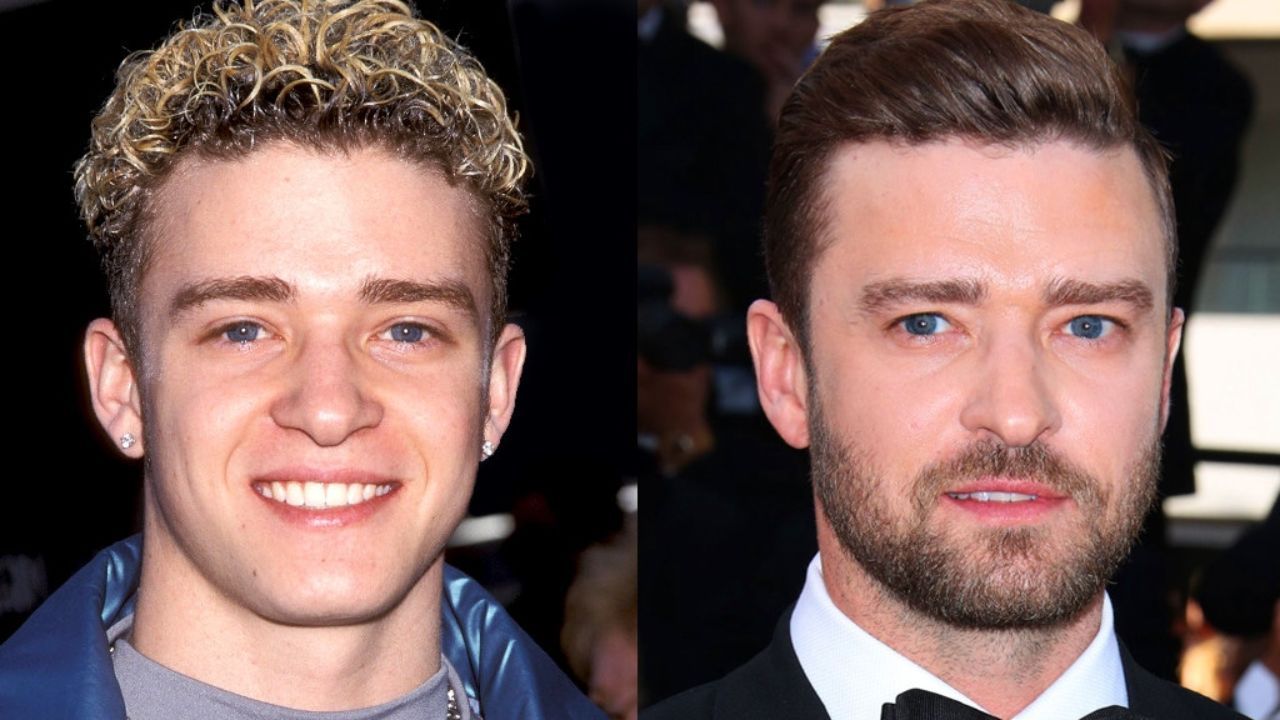 Justin Timberlake before and after plastic surgery.