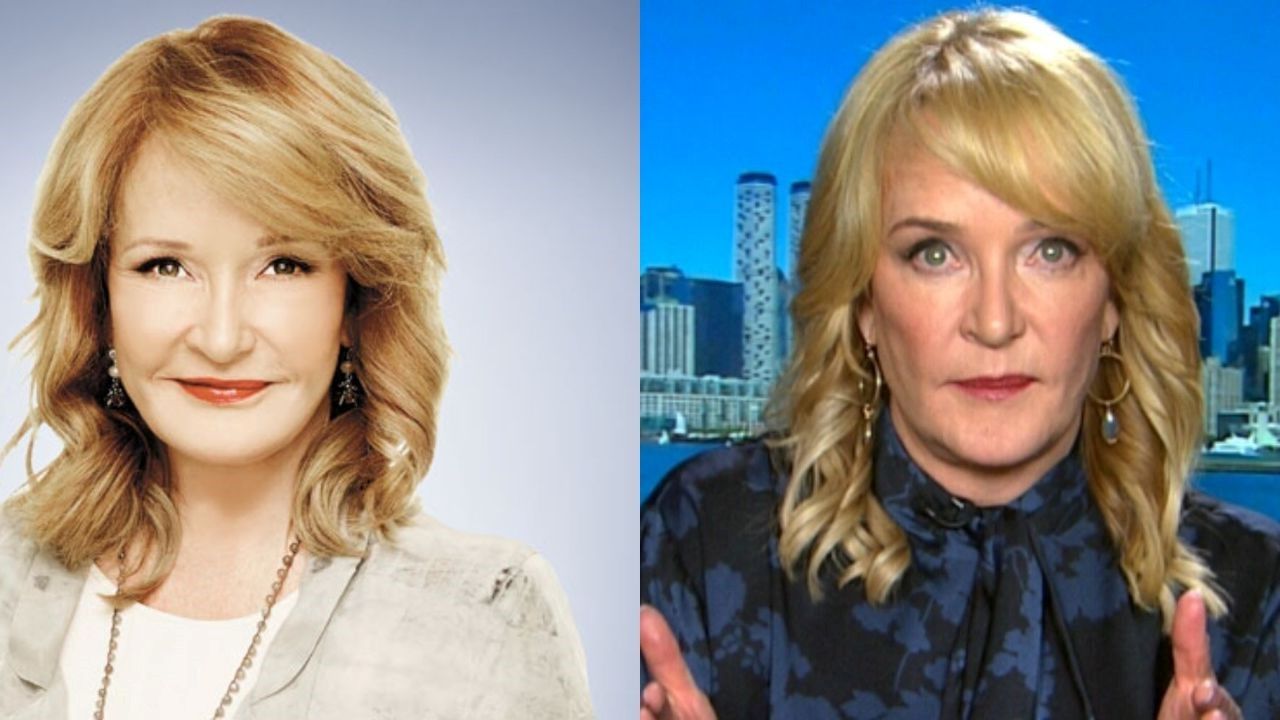 Marilyn Denis before and after plastic surgery.