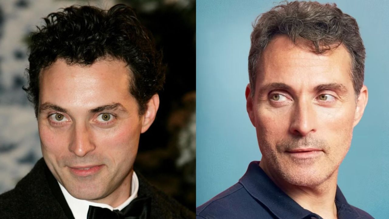 Rufus Sewell before and after plastic surgery.