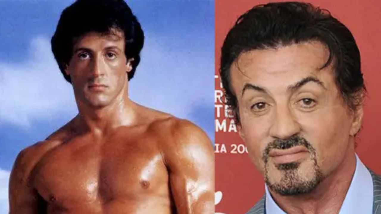 Sylvester Stallone before and after plastic surgery.